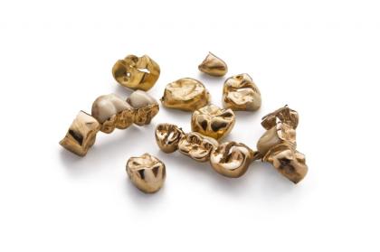 Lukrativer Zahngold Dentalgold Zahnbrücken Ankauf Berlin
