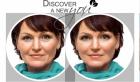 Beautybehandlung nach Starrezeptur